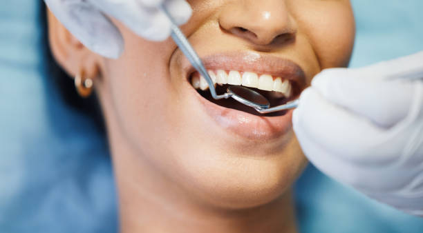 Best Broken or Chipped Tooth Repair in , ND