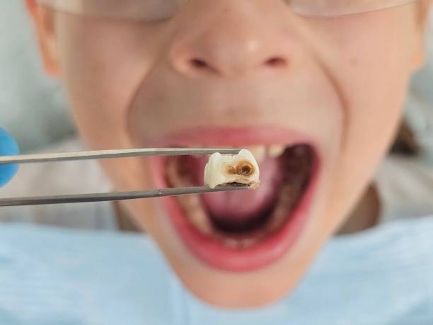 Best Emergency Pediatric Dental Care in , ND